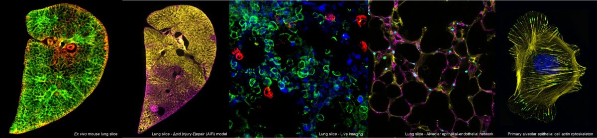 Lung Development & Repair Group